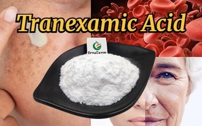 Tranexamic Acid 1 Tranexamic Acid 1